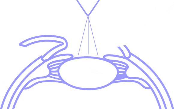 Dry eye doctors LASIK surgery icon