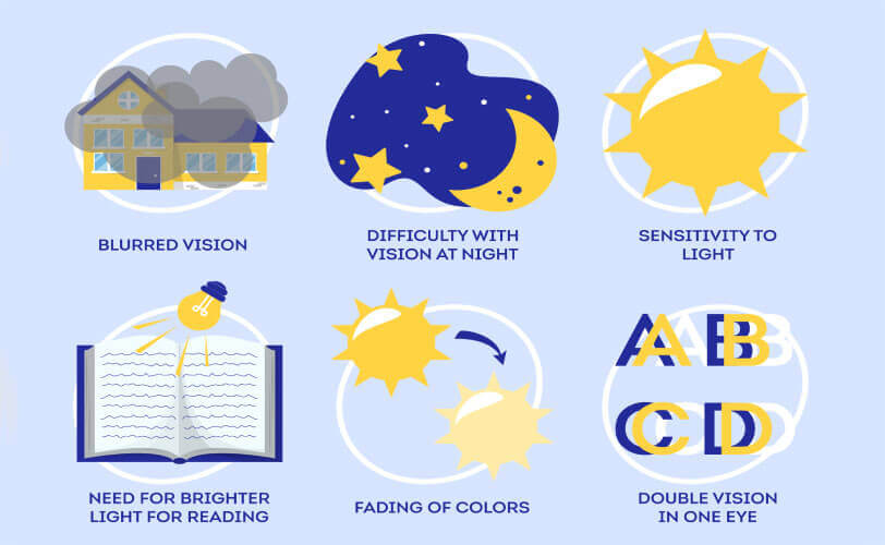 Symptoms and risk factors of cataracts illustration