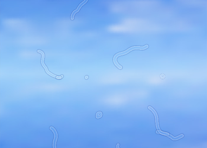 Eye Floaters And Flashes California LASIK Eye