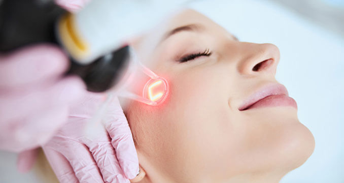 Mixto fractional CO2 laser resurfacing at California LASIK and Eye