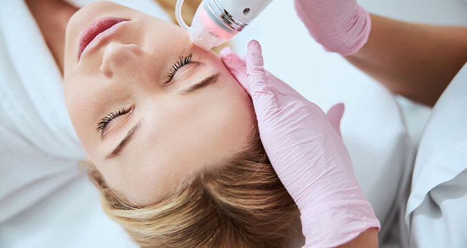 Radio Frequency Microneedling at California LASIK and Eye