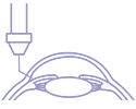 Glaucoma surgical treatment icon