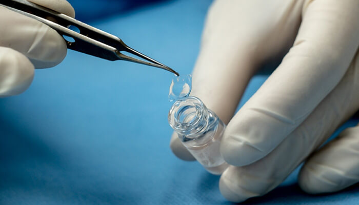 Intraocular contact lens at California LASIK and Eye